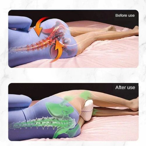 SleepAlign Ergonomic Leg Pillow with Support Strap